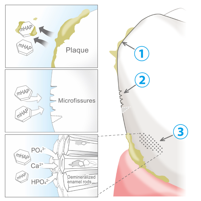 اثر خمیر (GC Tooth Mousse (CPP-ACP و (MI Paste plus (CPP-ACPF بر روند تغییرات pH پلاک پس از مصرف مواد قندی